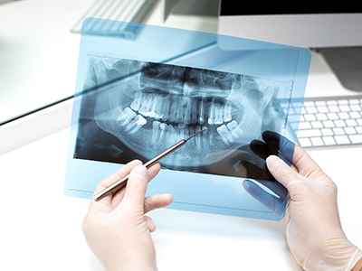 Cosmodent Candelaria - Clínica Dental en Tenerife | Home