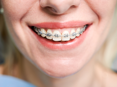 Cosmodent Candelaria - Clínica Dental en Tenerife | Home