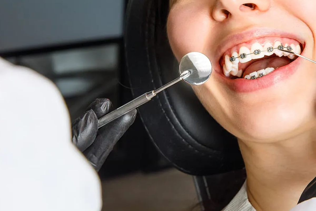 post28_2 Cosmodent Candelaria - Clínica Dental en Tenerife | Nuevo método en ortodoncia: Microtornillos