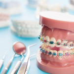 post28_4 Cosmodent Candelaria - Clínica Dental en Tenerife | Arcos dentales vs. hilo dental tradicional: ¿cuál es mejor?