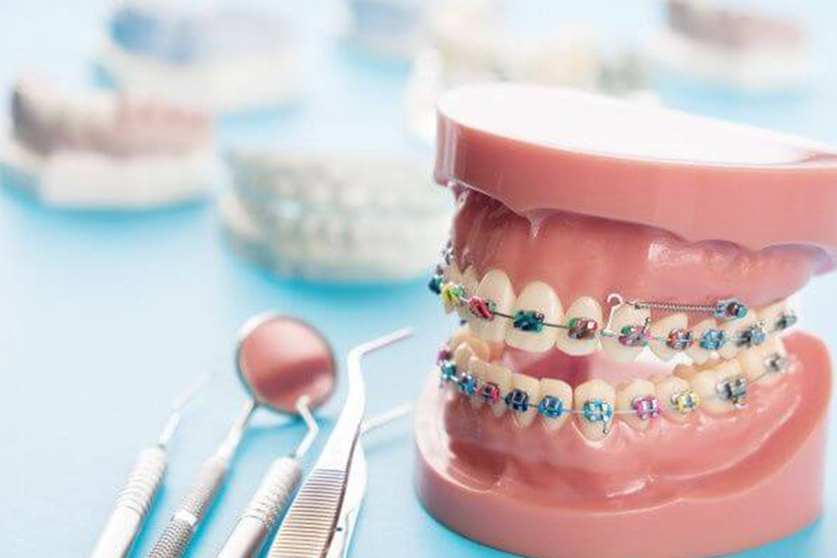 post28_4 Cosmodent Candelaria - Clínica Dental en Tenerife | Nuevo método en ortodoncia: Microtornillos