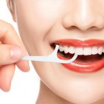 Post29_1 Cosmodent Candelaria - Clínica Dental en Tenerife | Nuevo método en ortodoncia: Microtornillos