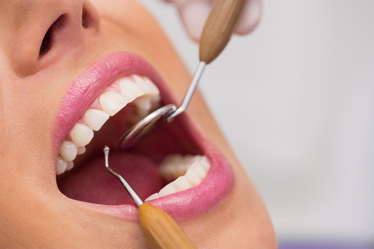 dentista-examinando-los-dientes-del-paciente-femenino Cosmodent Candelaria - Clínica Dental en Tenerife | Reconstrucción con poste dental: qué es, para qué sirve y cuándo se recomienda