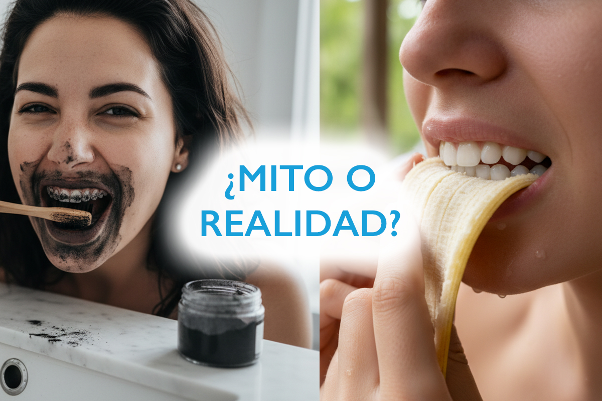 DESTACADA Cosmodent Candelaria - Clínica Dental en Tenerife | ¿Blanquear los dientes en casa? La verdad sobre el carbón activado y la cáscara de plátano