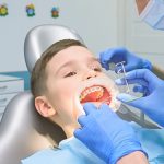 Cosmodent Candelaria - Clínica Dental en Tenerife | ¿Un diente puede cambiar de color tras un golpe?